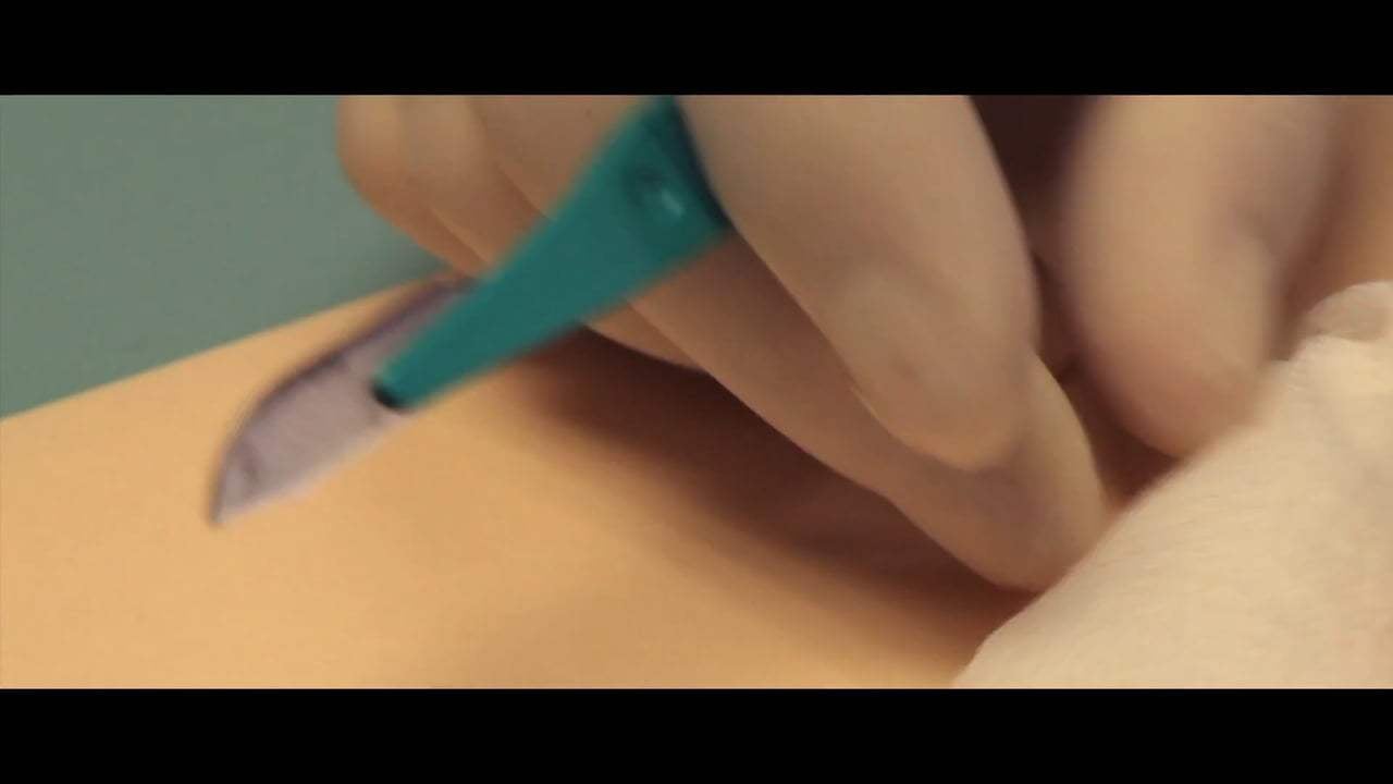 Patient Seventeen Trailer (2017) Screen Capture #3